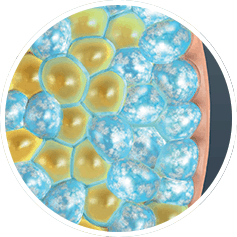 Fat Freezing Cross Section