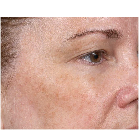 image1 - clear and brilliant skin