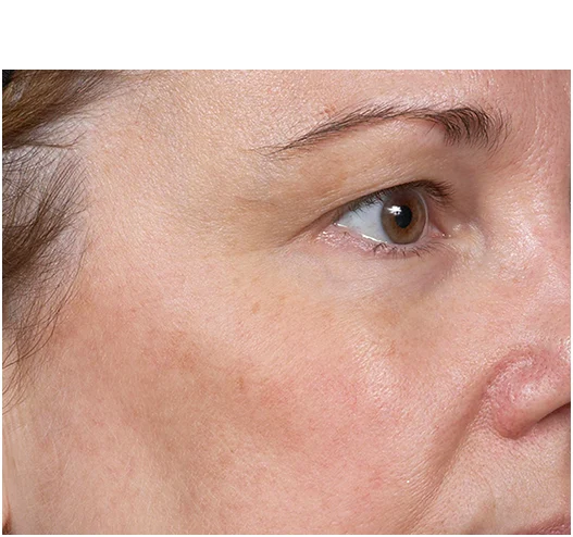 image 2 - clear and brilliant skin