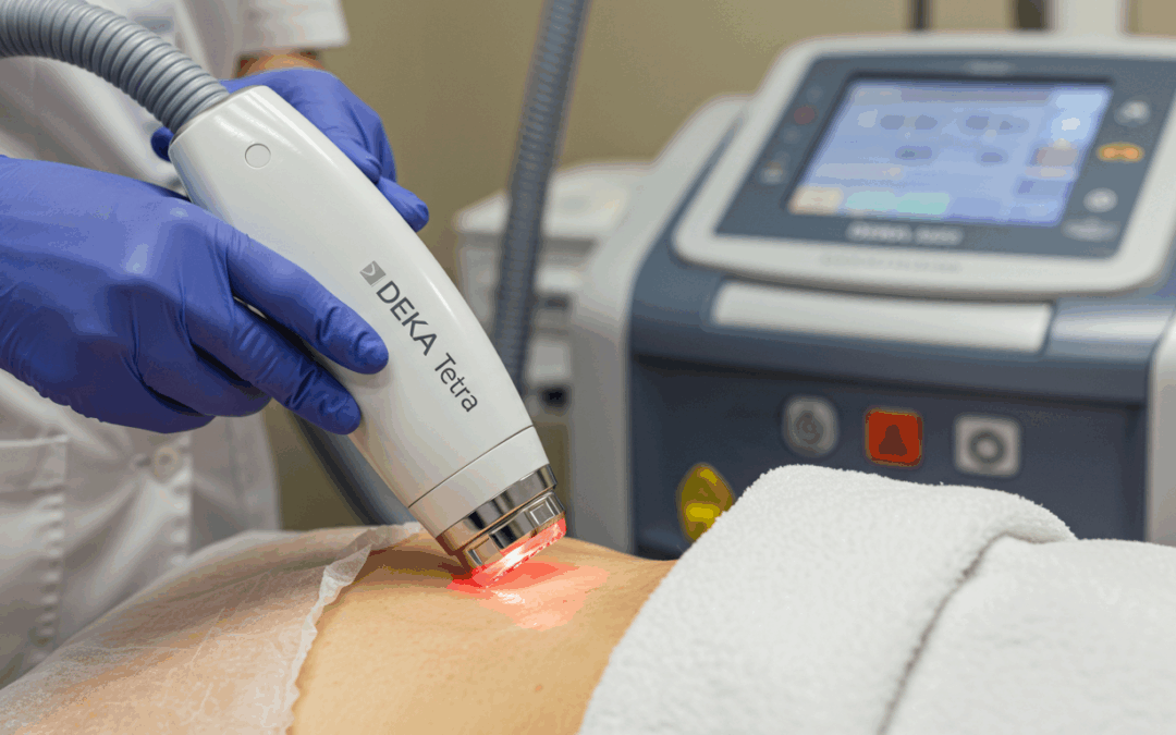 Skin Resurfacing with CO₂ and the CoolPeel Tetra PRO: A Modern Approach to Radiant Skin When